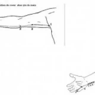 croquis du méridien de la vésicule biliaire