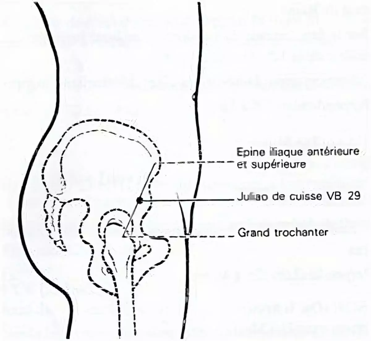 croquis du méridien de la vésicule biliaire