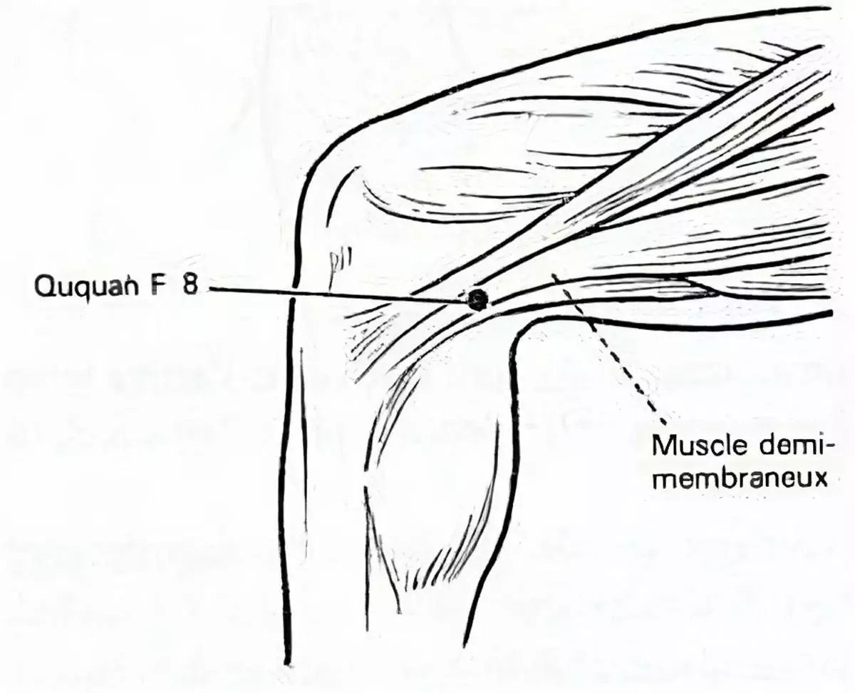 meridien-du-foie-7-transformed